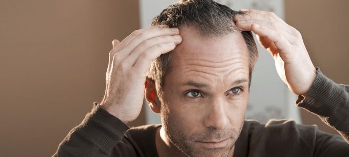 hair-thinning-loss-biotin-vitamin-b7