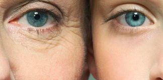 Eye Wrinkle Treatment